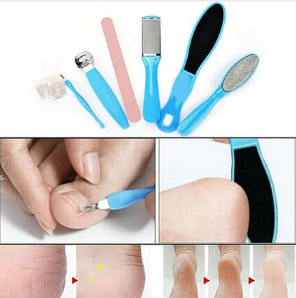 6 Pcs Foot Rasp File Scrubber Hard Dead Rough Skin Callus Remover
