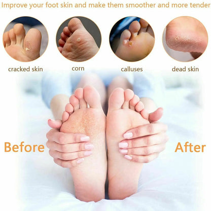 6 Pcs Foot Rasp File Scrubber Hard Dead Rough Skin Callus Remover
