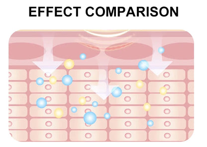 The Latest Generation Small Bubble Dermabrasion Machine - 8 In 1 Aqua Facial Peel, BIO Facial Wrinkle Remover & Skin Cleansing,