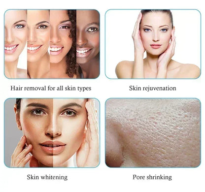 808 Diode Laser Hair Removal Machine 755 808 1064nm Wavelengths Cooling Head Painless Laser Epilator Face Body Hair Removal