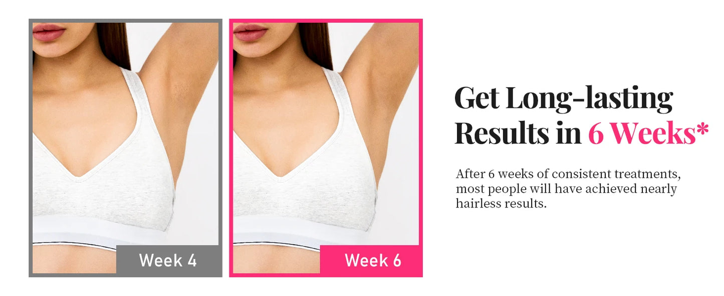 990000 Flashes Laser Hair Removal for Women and Men IPL Hair Removal Body Bikini and Facial Areas Painless Permanent HairRemoval