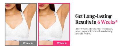 990000 Flashes Laser Hair Removal for Women and Men IPL Hair Removal Body Bikini and Facial Areas Painless Permanent HairRemoval