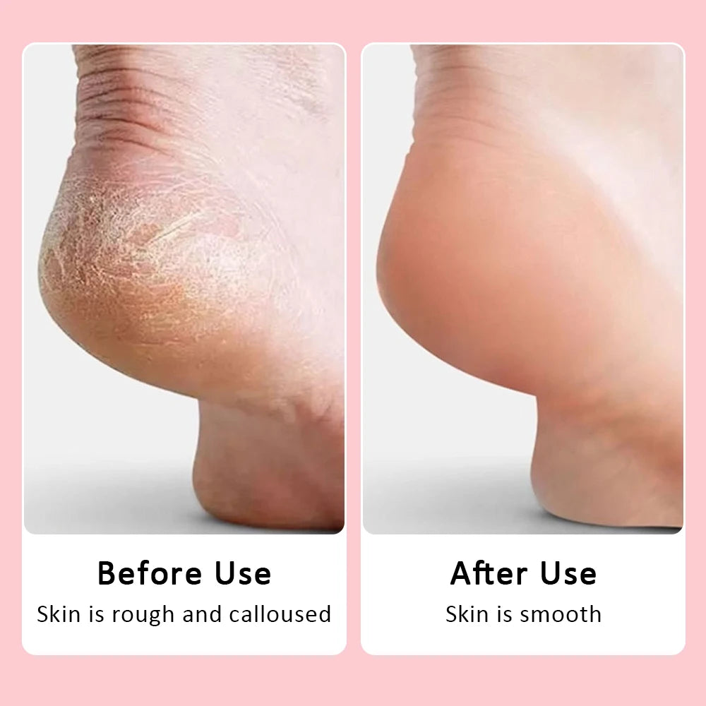 Wireless Foot Care File Leg Heels Remove USB Rechargeable Dead Skin Pedicure Tool with Replacement Sandpaper Foot Care Tool