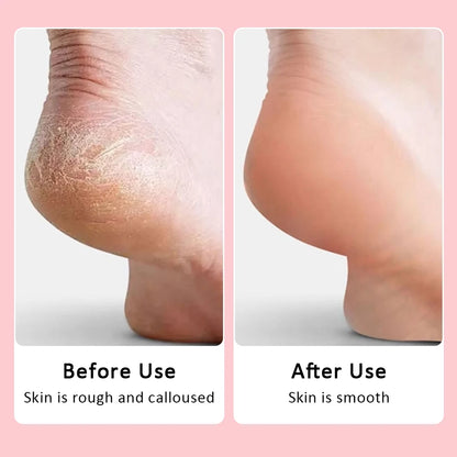 Wireless Foot Care File Leg Heels Remove USB Rechargeable Dead Skin Pedicure Tool with Replacement Sandpaper Foot Care Tool