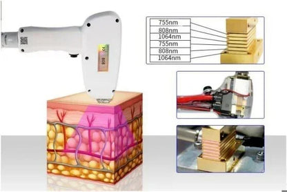 808 Diode Laser Hair Removal Machine 755 808 1064nm Wavelengths Cooling Head Painless Laser Epilator Face Body Hair Removal