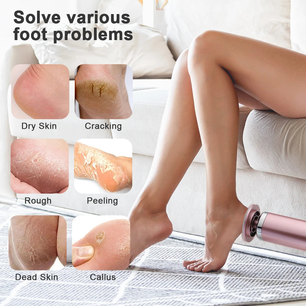 Electric Foot Callus Remover Nail Polisher 2-in-1 6-Speed Dual Grinding Heads Pedicure Tool for Smooth Heels Dead Skin Removal